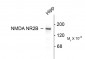 NMDA Receptor, NR2B Subunit Antibody