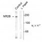 Phospho-Tyr1336 NMDA Receptor NR2B Subunit Antibody