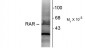 Retinoic Acid Receptor, α-Isotype Antibody