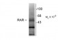 Retinoic Acid Receptor, β-Isotype Antibody