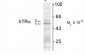 Thyroid Hormone Receptor, α1/α2-Isotype Antibody