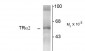 Thyroid Hormone Receptor, α2-Isotype Antibody