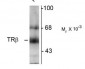 Thyroid Hormone Receptor, β-Isotype Antibody