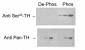 Phospho-Ser40 Tyrosine Hydroxylase Antibody