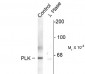 Phospho-Thr210 Polo-like Kinase 1 Antibody