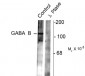 Phospho-Ser783 GABAB R2 Antibody