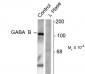 Phospho-Ser923 GABAB R1 Antibody