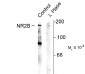 Phospho-Ser1480 NMDA Receptor NR2B Subunit Antibody
