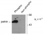 Phospho-Ser101 Parkin Antibody