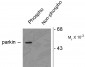 Phospho-Ser378 Parkin Antibody