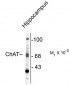 Choline Acetyltransferase Antibody
