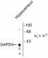 Glyceraldehyde 3-Phosphate Dehydrogenase (GAPDH) Antibody
