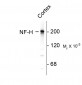 Neurofilament H (NF-H) Antibody