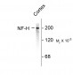 Neurofilament H (NF-H) Antibody