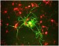 Neurofilament M (NF-M) Antibody