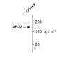Neurofilament M (NF-M) Antibody
