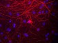 Neurofilament M (NF-M) Antibody