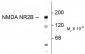 NMDA Receptor, NR2B Subunit N-terminus Antibody