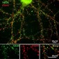 NMDA Receptor, NR2B Subunit N-terminus Antibody