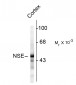 Neuron Specific Enolase (NSE) Antibody