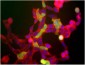 Neuron Specific Enolase (NSE) Antibody