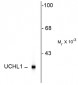 Ubiquitin C Terminal Hydrolase 1 (UCHL1) Antibody