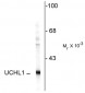 Ubiquitin C Terminal Hydrolase 1 (UCHL1) Antibody