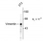 Vimentin Antibody