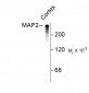 Microtubule Associated Protein 2 (MAP2) Antibody