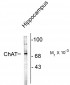 Choline Acetyltransferase Antibody