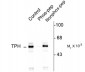 Phospho-Ser260 Tryptophan Hydroxylase Antibody
