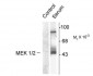 Phospho-Ser218,222 MEK 1/2 Antibody