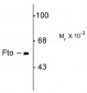 Fto (Fat mass and obesity-associated protein) Antibody