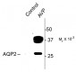 Phospho-Ser269 Aquaporin 2 Antibody