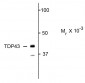 TDP43 Antibody