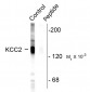 Phospho-Ser940 Potassium Chloride Cotransporter (KCC2) Antibody