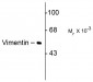 Vimentin  Antibody