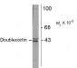 Doublecortin (DCX) Antibody