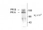 Phospho-Ser190 Progesterone Receptor  Antibody