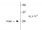 TFAM (Transcription Factor A, mitochondrial) Antibody