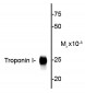 Troponin I (cardiac) Antibody