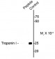 Phospho-Ser23/24 Troponin I (cardiac) Antibody