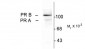 Phospho-Ser294 Progesterone Receptor  Antibody