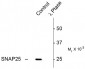 Phospho-Ser187 SNAP25 Antibody