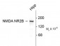 NMDA Receptor, NR2B Subunit Antibody