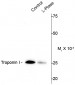 Phospho-Ser43 Troponin I (cardiac) Antibody