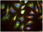 Lysosomal Associated Membrane Protein 1 (LAMP1) Antibody