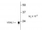 Visinin-Like Protein 1 (VSNL1) Antibody