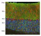 Visinin-Like Protein 1 (VSNL1) Antibody