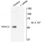 Phospho-Ser394 HDAC2 Antibody